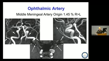 UCLA 101 Neurosurgery Series; Neurosurgery; Neuroradiology; Cerebral Blood Vessels;  Noriko Salamon, MD