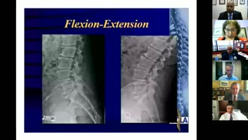Spine Disease I: What I would do in these cases?