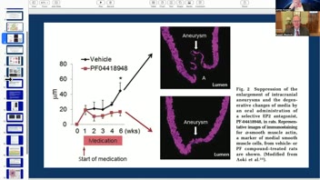Molceular Basis of Cerebral Aneurysm Formation; Dr. Blaylock Reports